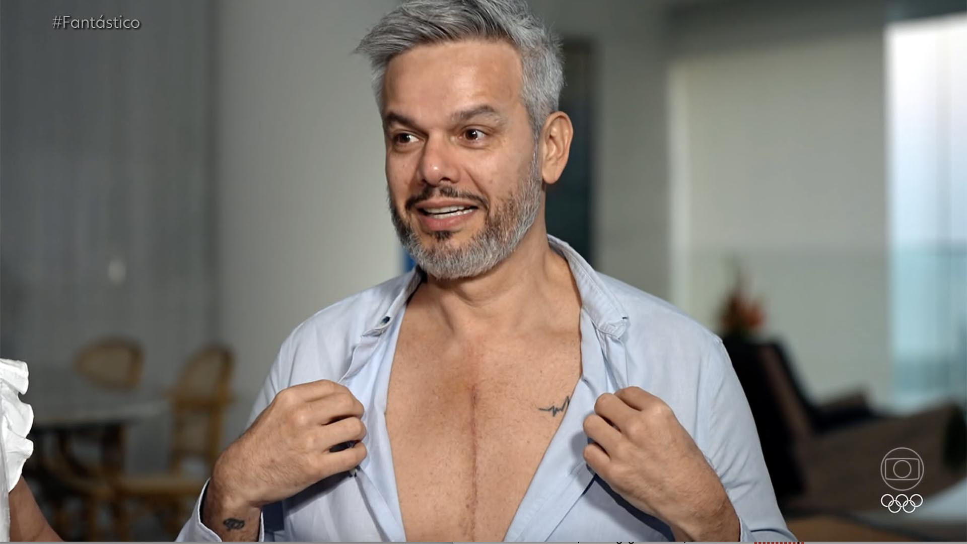 Linha do tempo da saúde de Otaviano Costa: Do aneurisma à volta ao trabalho