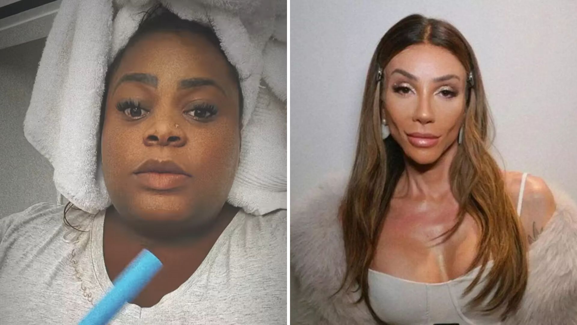 Famosos apostam em Ozempic e médico faz alerta: ‘Distúrbios’