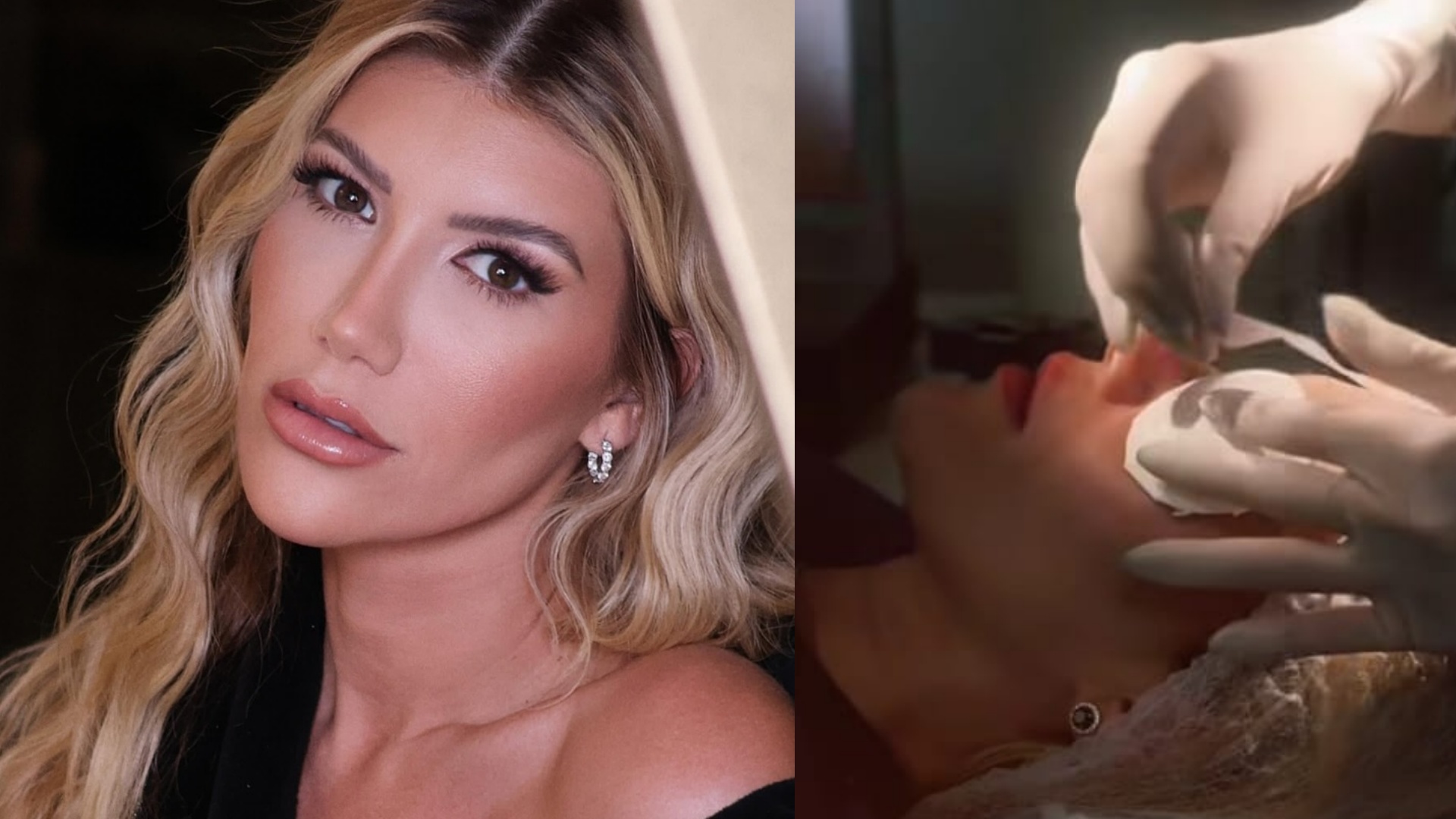 Esposa do cantor Cristiano tranquiliza os fãs após passar por cirurgia nos olhos