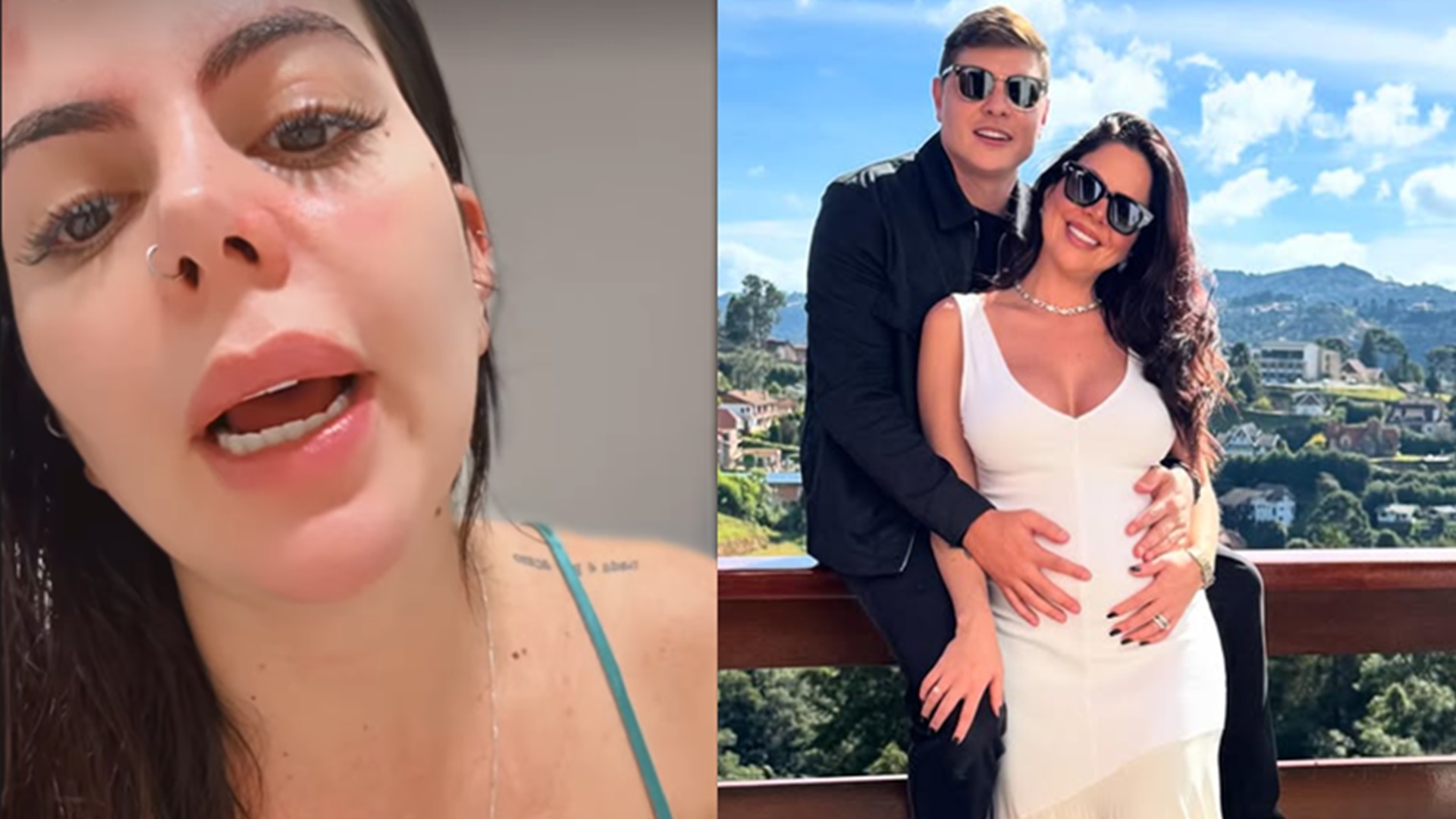 Grávida, ex-Casamento às Cegas sofre queimaduras após panela de pressão explodir