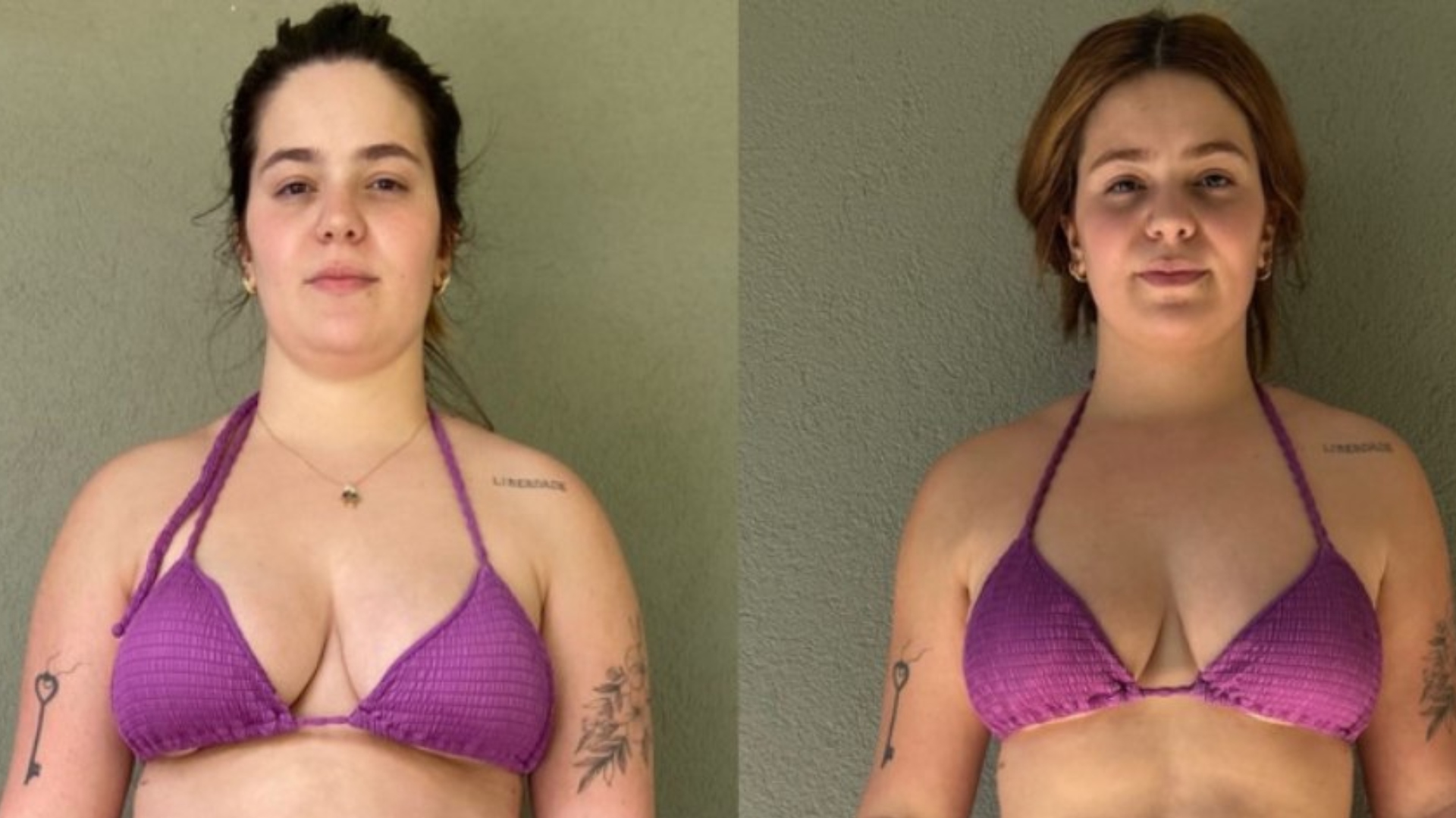 Viih Tube emagrece 15 quilos, e especialista alerta sobre antes e depois: ‘Isso só acontece quando…’