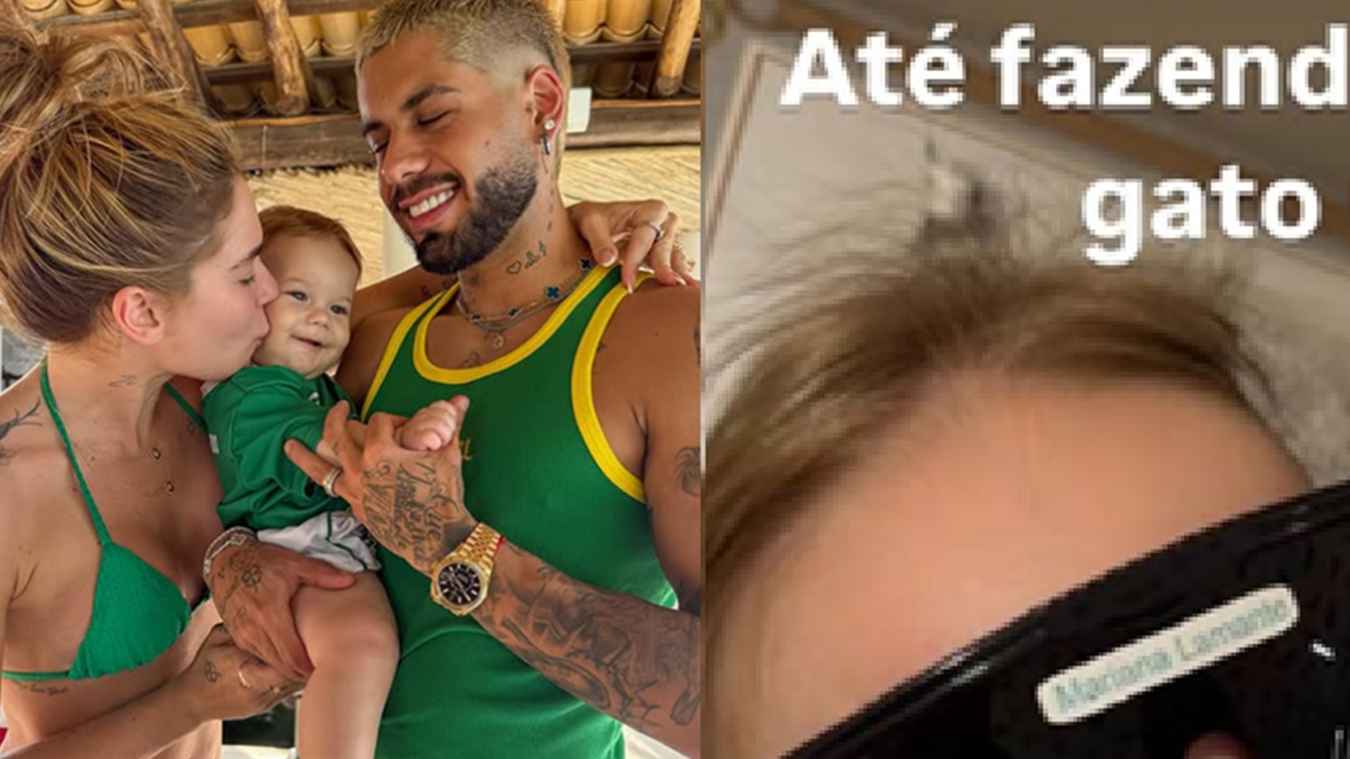 Virginia Fonseca mostra o filho fazendo tratamento com laser
