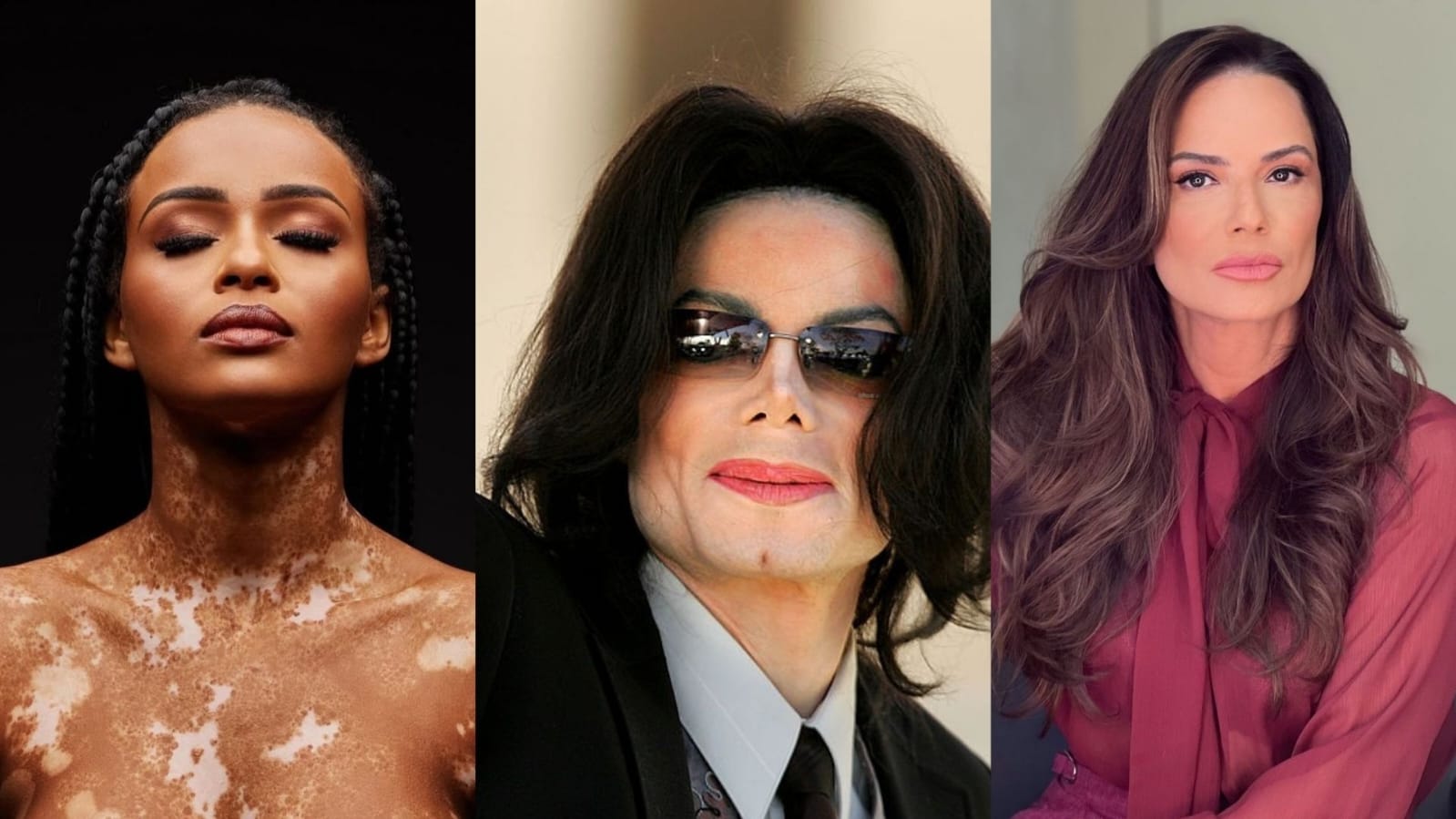 Especialista explica condição de pele dos famosos: ‘Imprevisível’