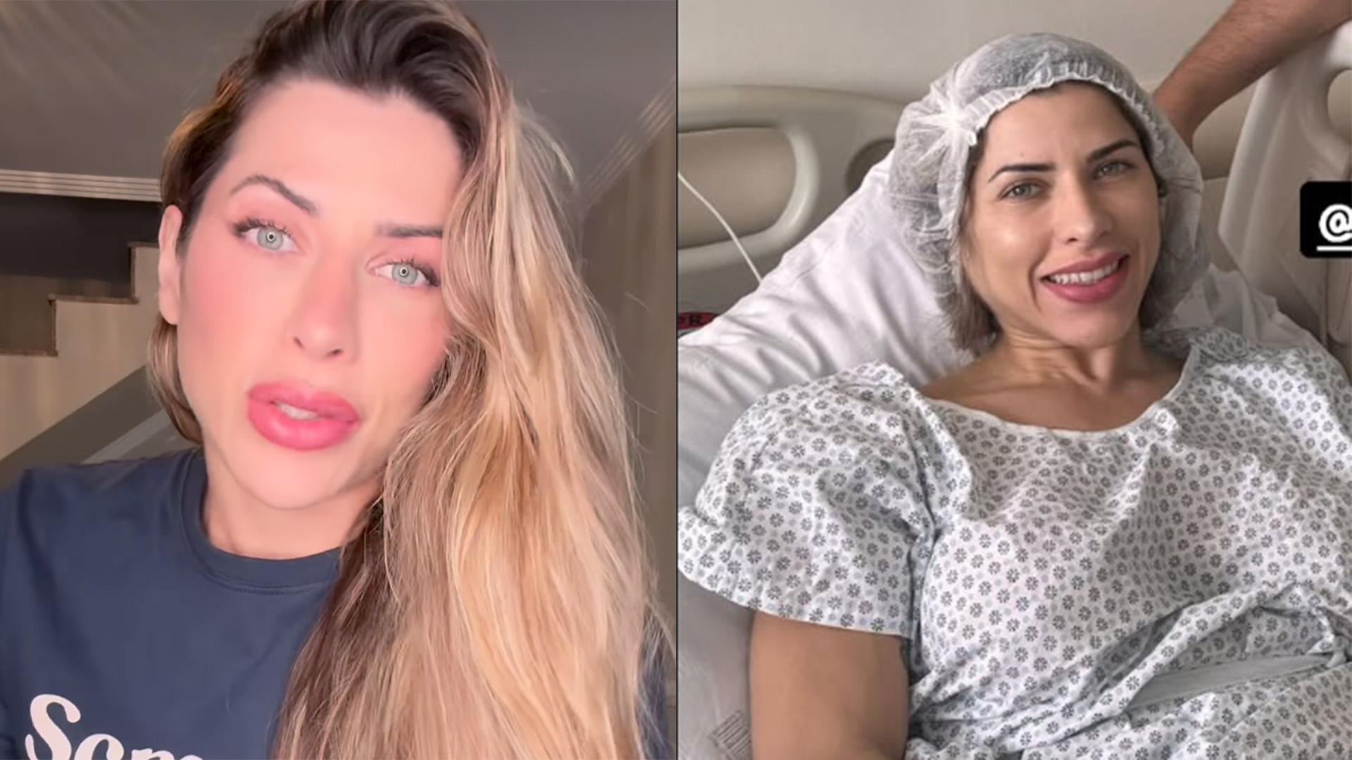 Ana Paula Minerato passa por cirurgia abdominal após dor intensa