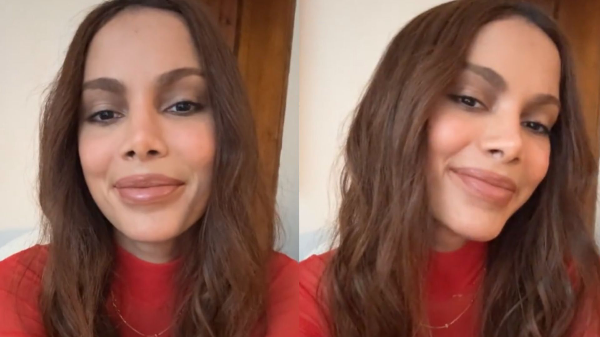 Anitta revela próxima mudança após procedimentos no rosto: ‘Decidi’