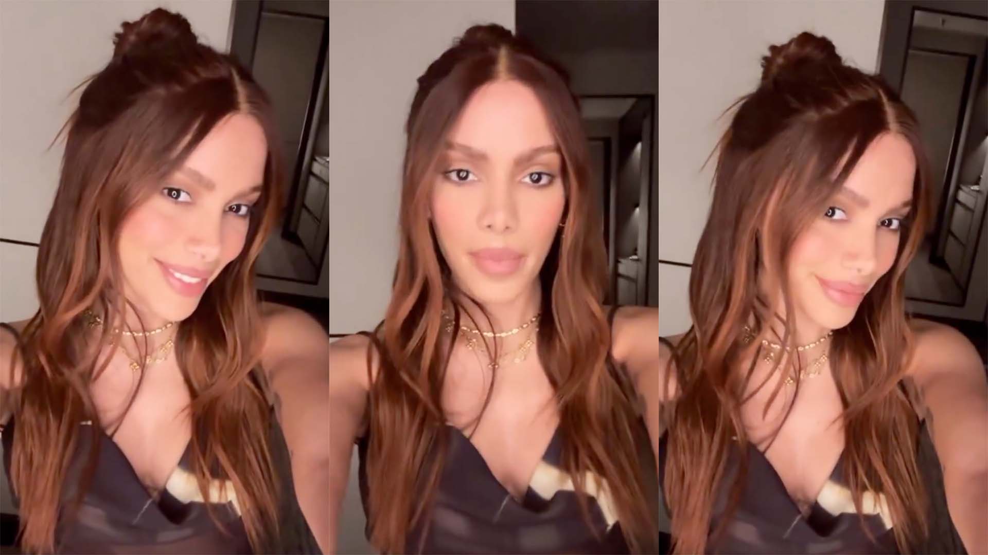 De nariz a bochechas: tudo que Anitta já falou sobre cirurgias plásticas