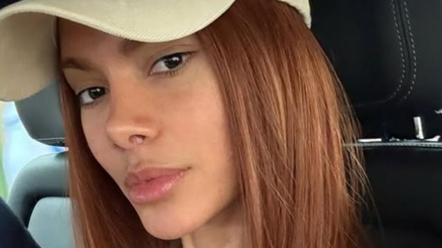 Anitta reaparece com rosto renovado e acende debates sobre estética, autoestima e identidade