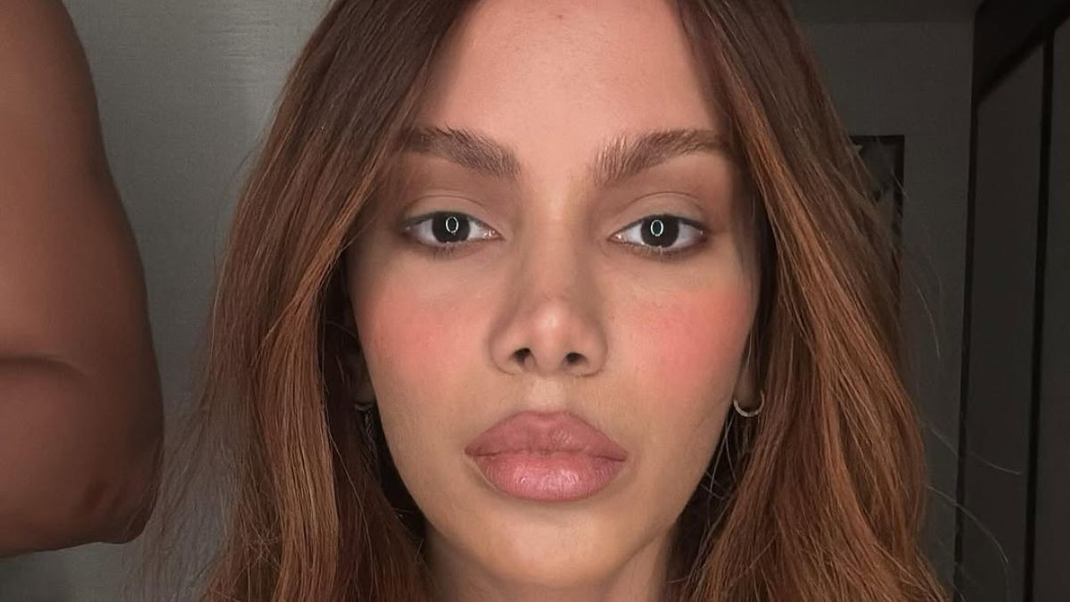 Médico alerta sobre infecção de Anitta: ‘Complicações’