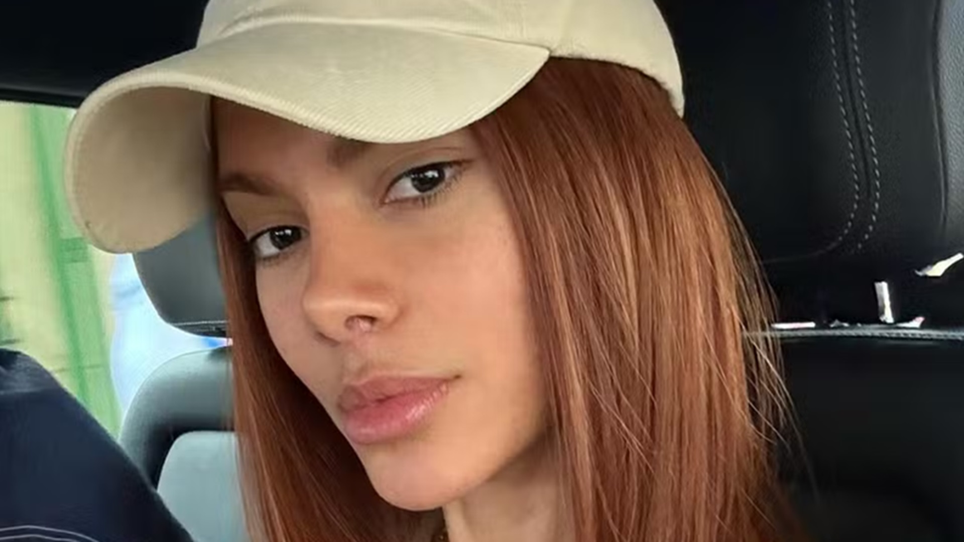 Anitta exibe o rosto após procedimentos estéticos e faz rara aparição com affair