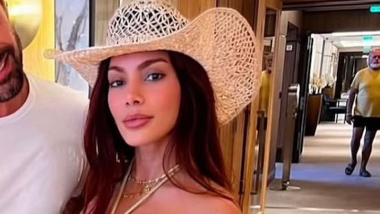 Anitta surge com ‘novo rosto’ e médico avalia atitude: ‘Evitar julgamentos’