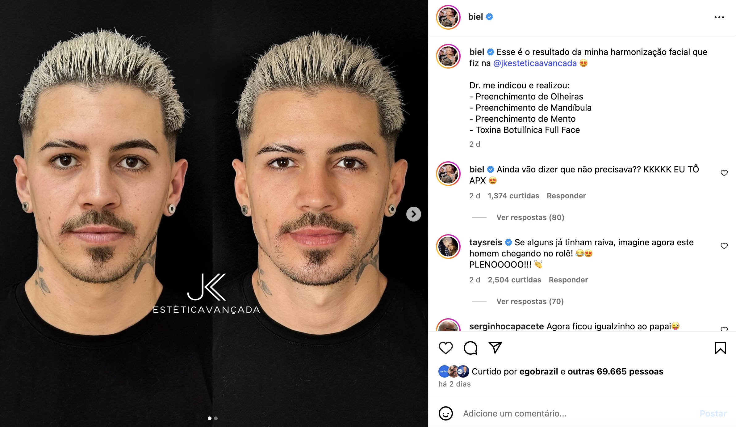 Antes e depois de Biel