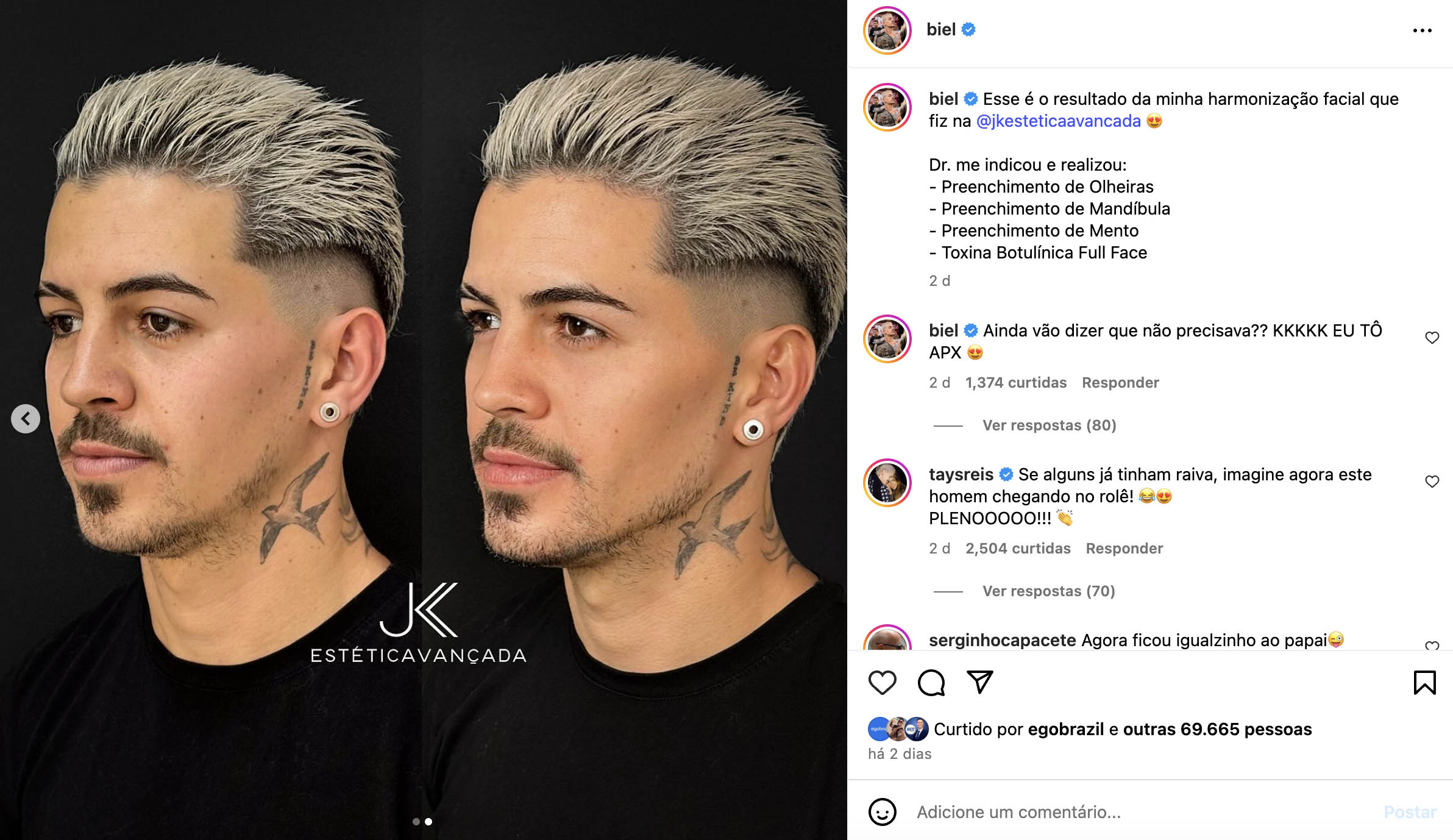 Antes e depois de Biel