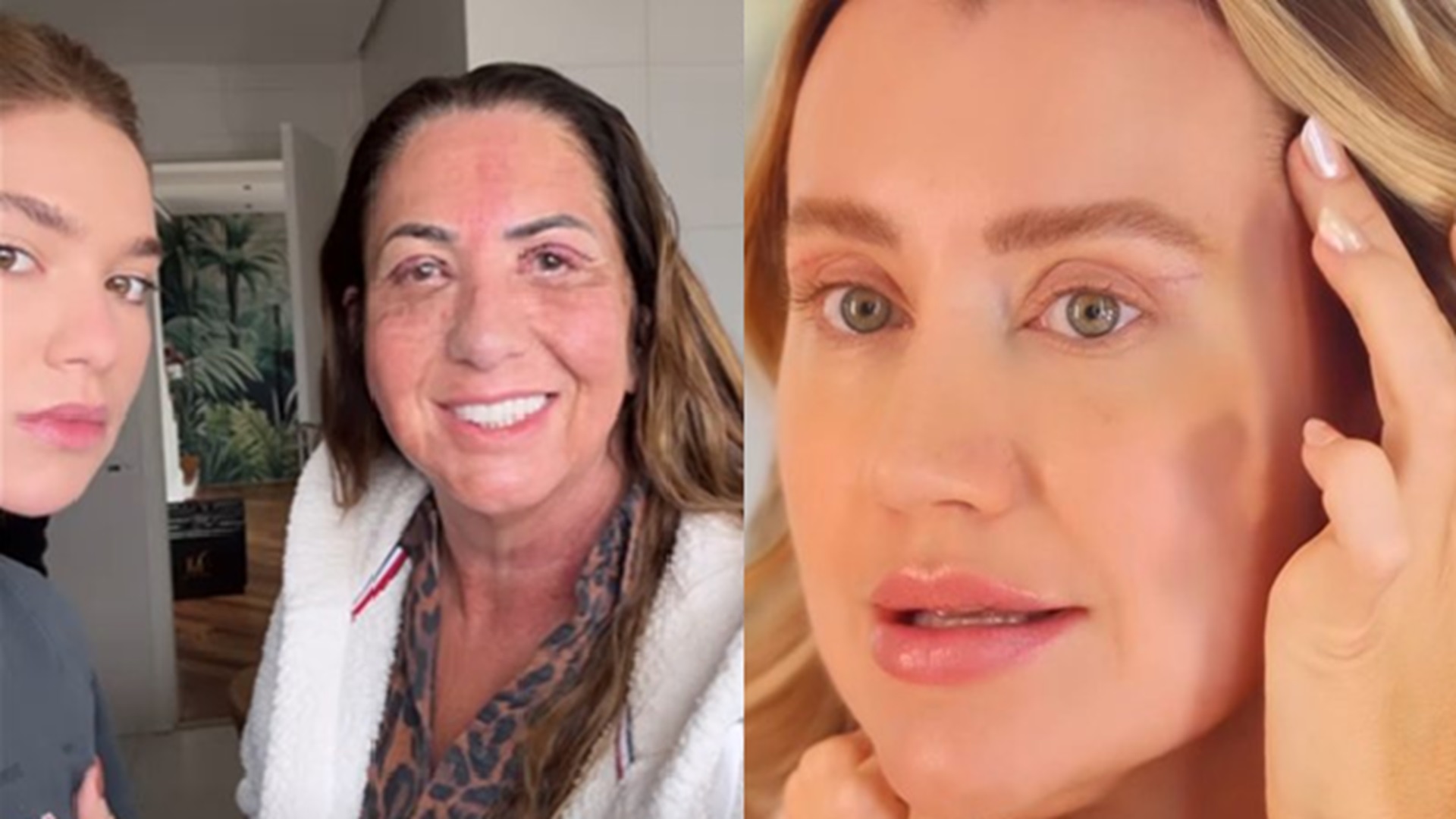 Mãe de Virginia, Ana Paula Siebert e outras aderiram: médica explica cirurgia feita por famosas