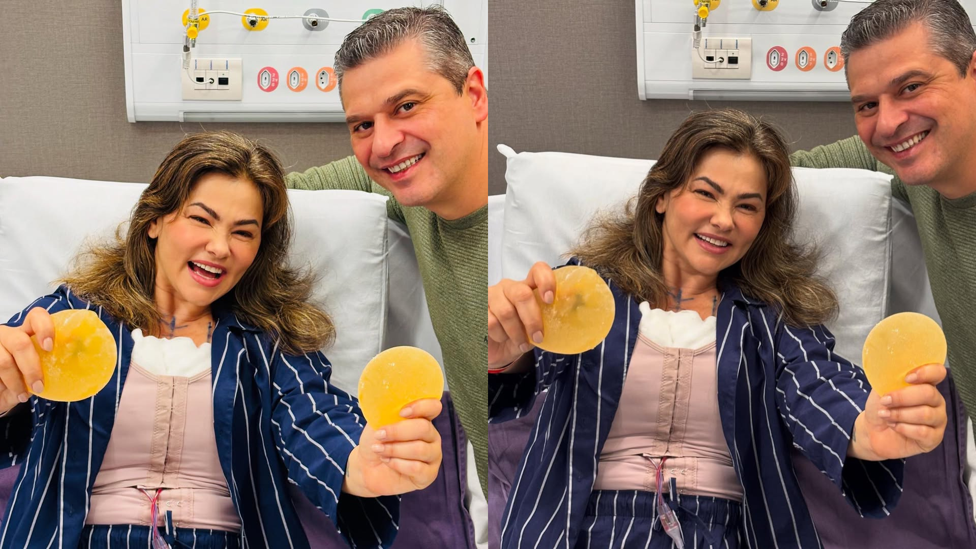 Suzana Alves retira silicone dos seios e médico explica sobre recuperação: ‘Resultado esperado’