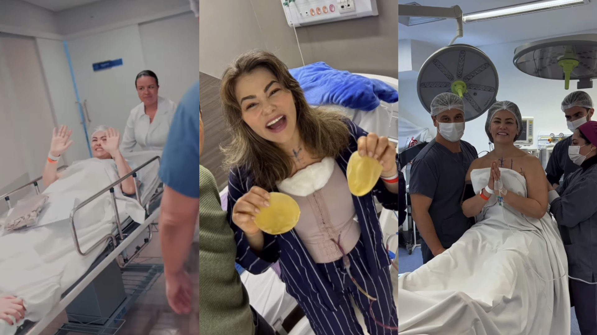Médico explica os riscos da retirada do silicone dos seios de Suzana Alves: ‘Com qualquer idade’
