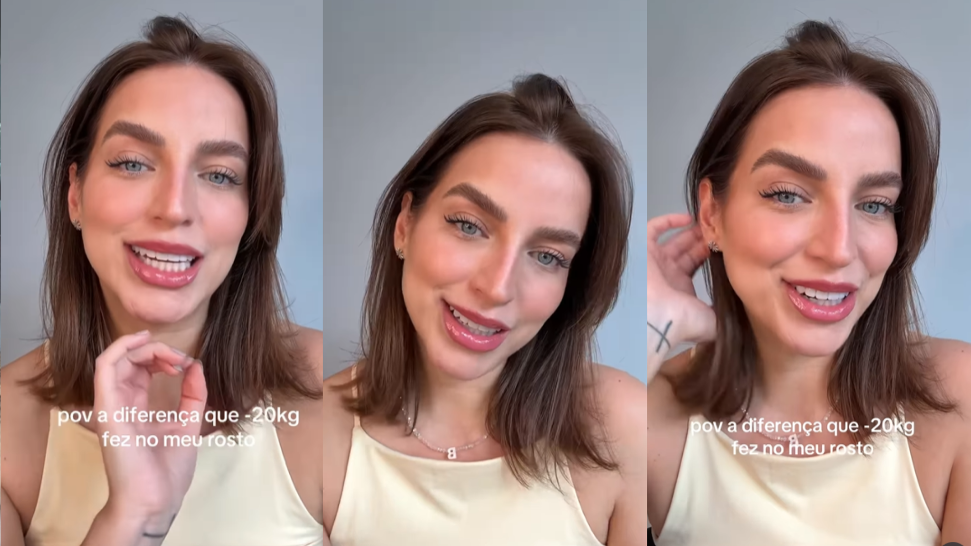 Bruna Unzueta chama a atenção com mudança no rosto após perder 20 kg e médico analisa: ‘Gordura’