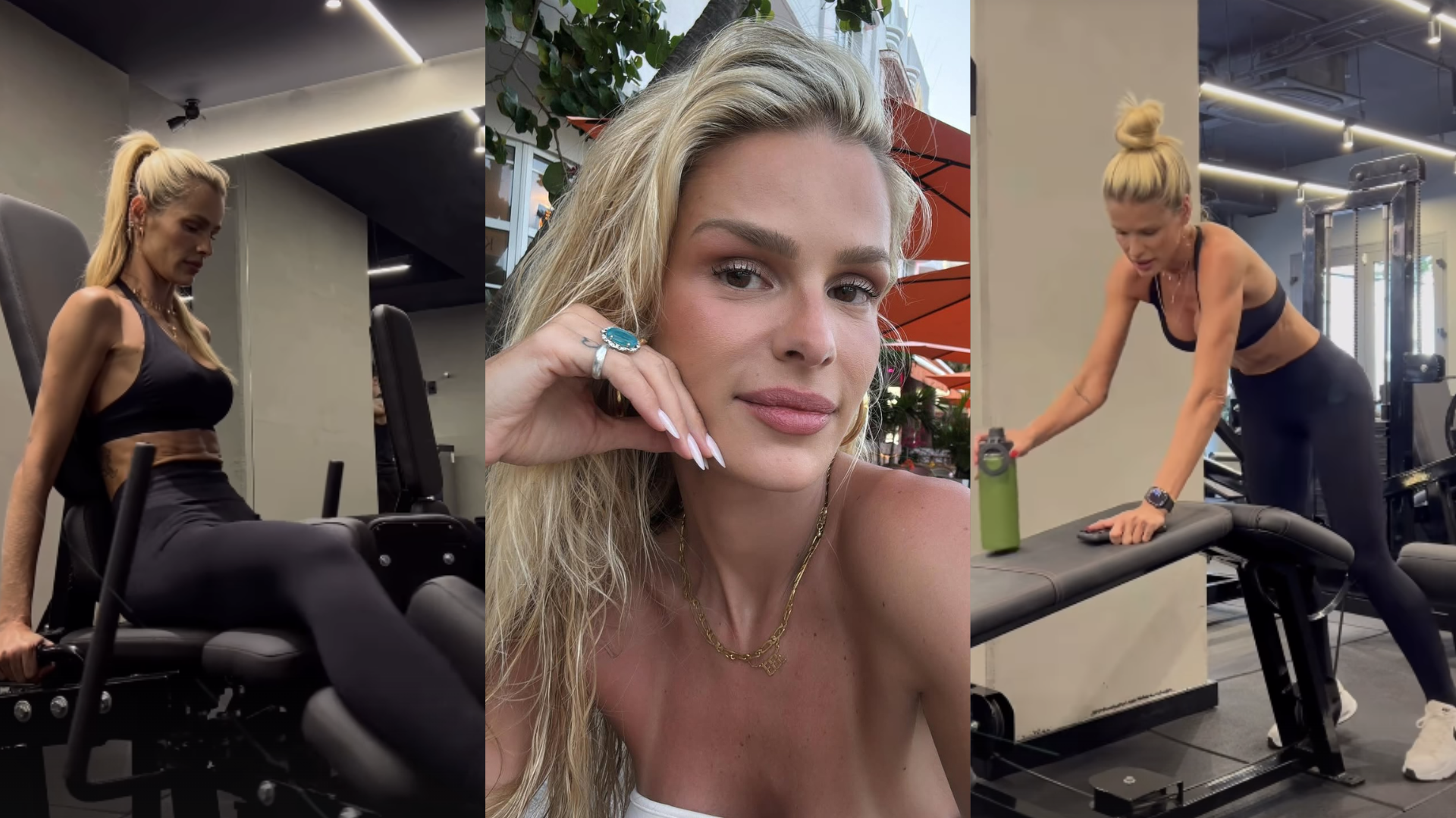 Especialista aponta cuidados na perda de peso de Yasmin Brunet: ‘Inflamação crônica’