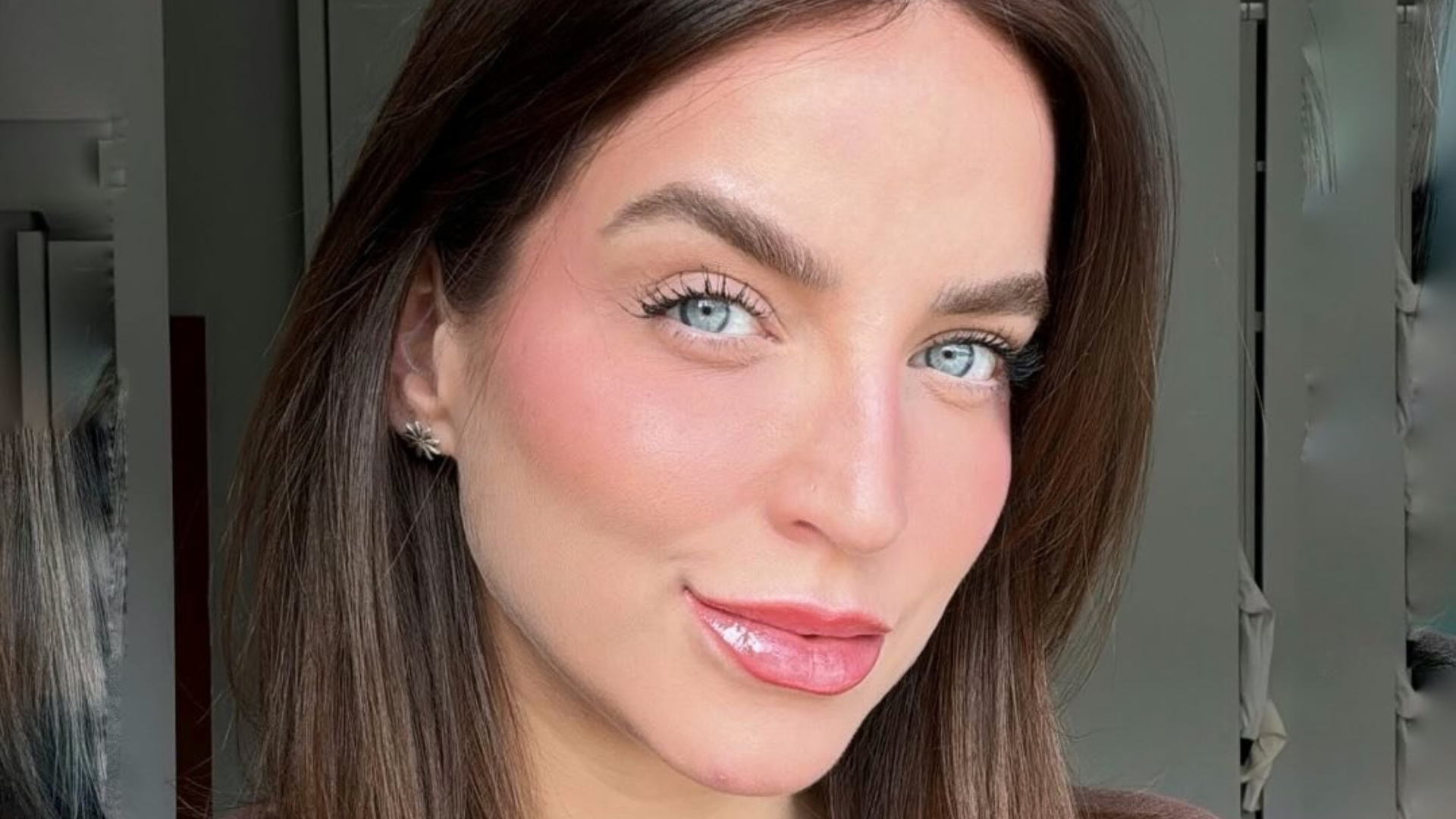 Bruna Unzueta relembra início de obesidade nível um e médico explica: ‘Risco de vários problemas’