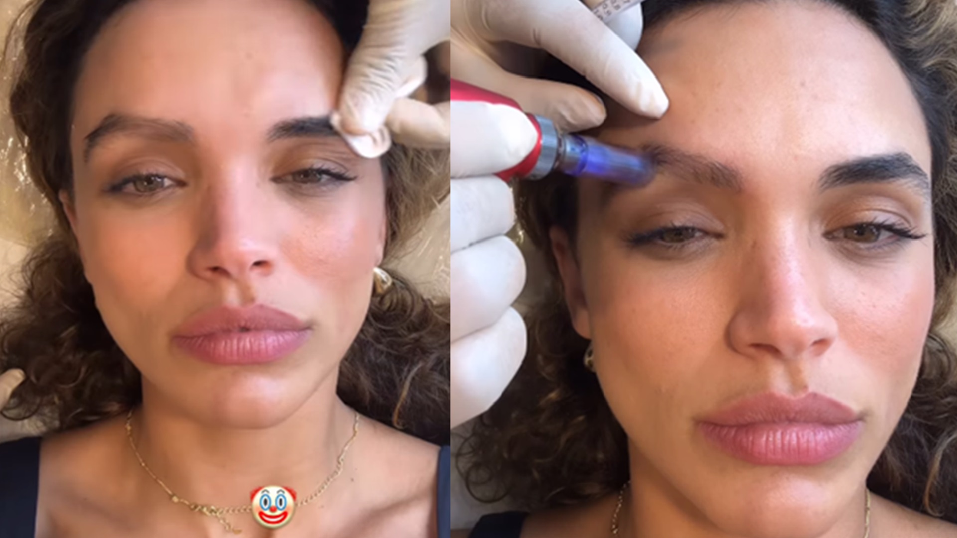 Giovana Cordeiro detalha tratamento após corte químico em sobrancelha: ‘Farei transplante’