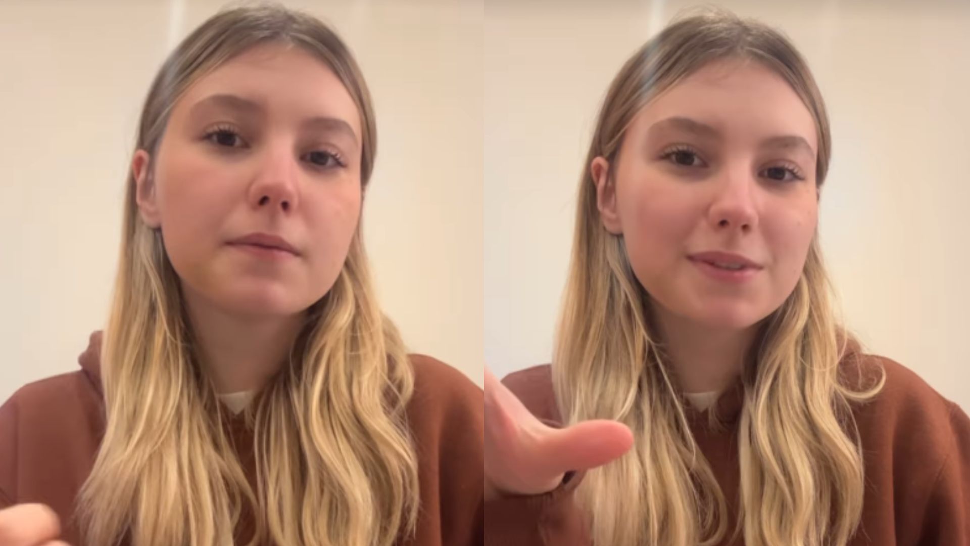 Isabel Veloso explica por que perderá o cabelo após novo transplante