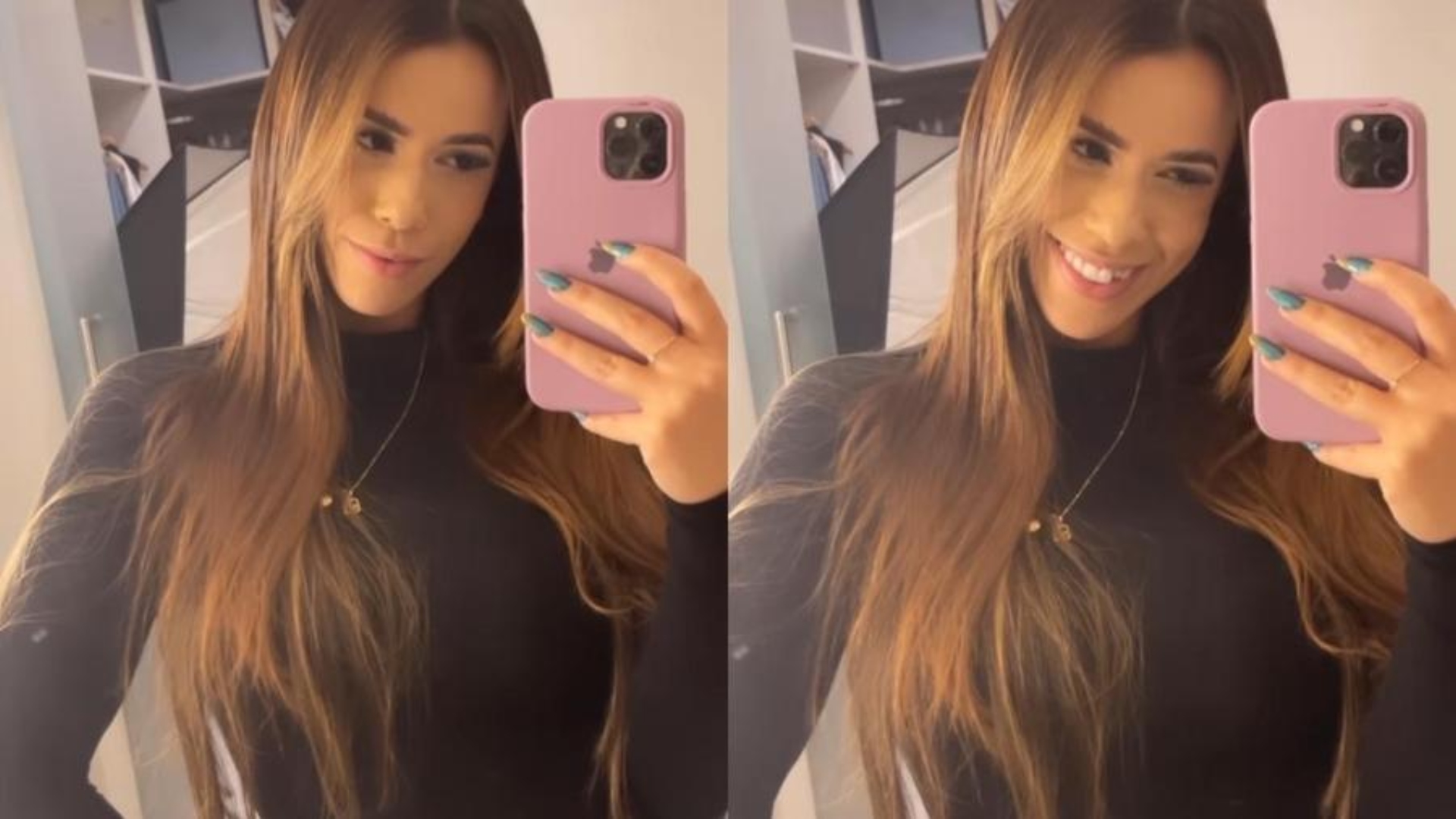 Dentista analisa queda de lente dental da ex-BBB Larissa Tomásia: ‘O paciente não é o responsável’