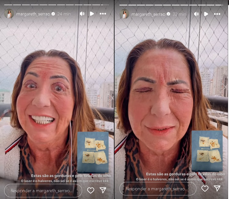Storie de Margareth Serr&atilde;o - Foto: Reprodu&ccedil;&atilde;o/Instagram 