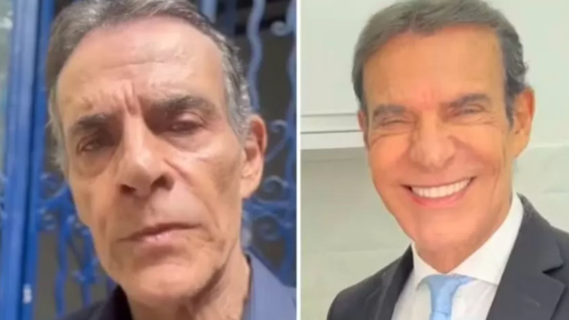 Antes e depois de M&aacute;rio Gomes 