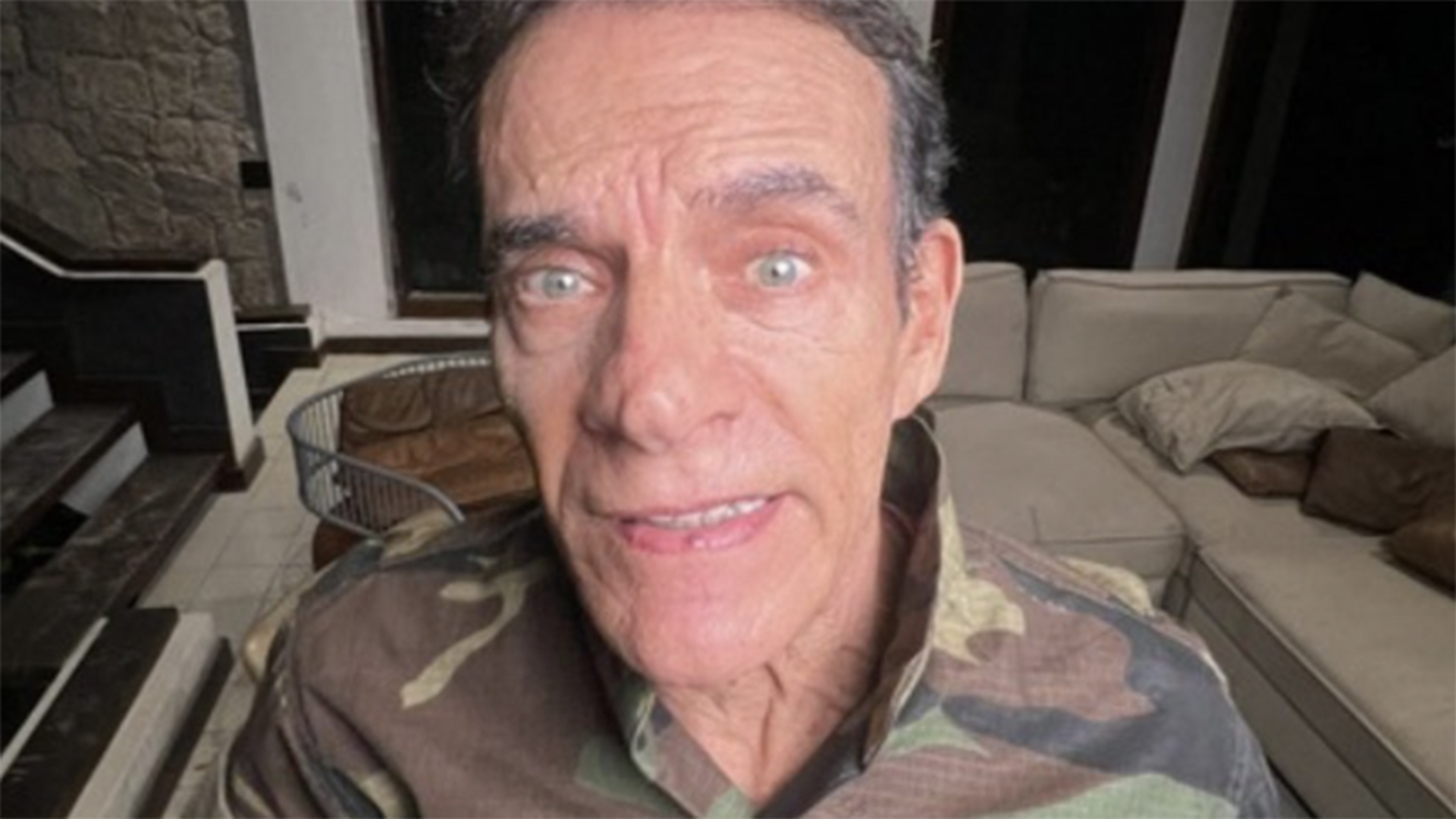 Mário Gomes realiza harmonização facial e exibe novo visual aos 72 anos