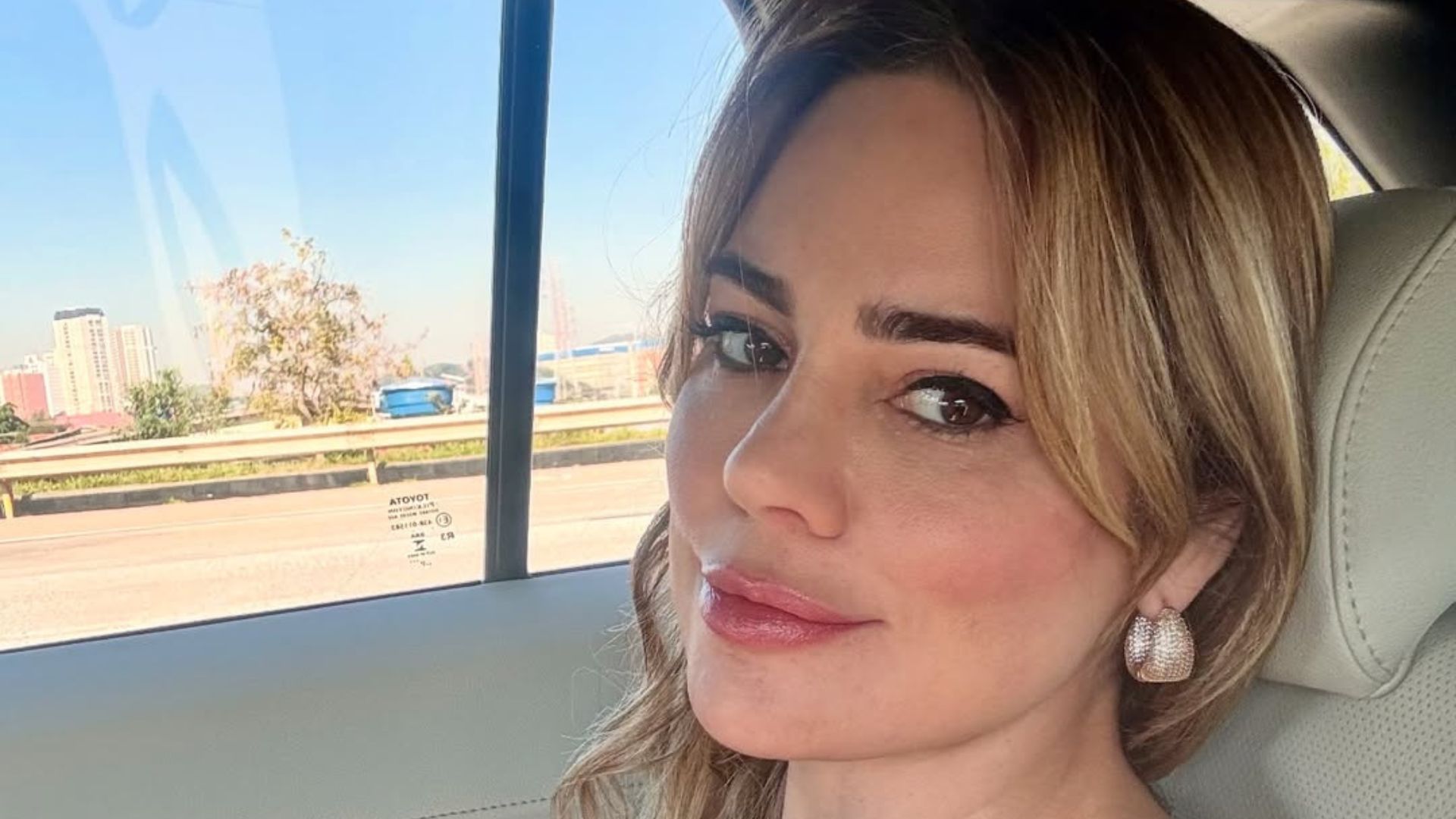 Médica orienta Rachel Sheherazade após técnica estética: ‘Resultado inicial não é o definitivo’