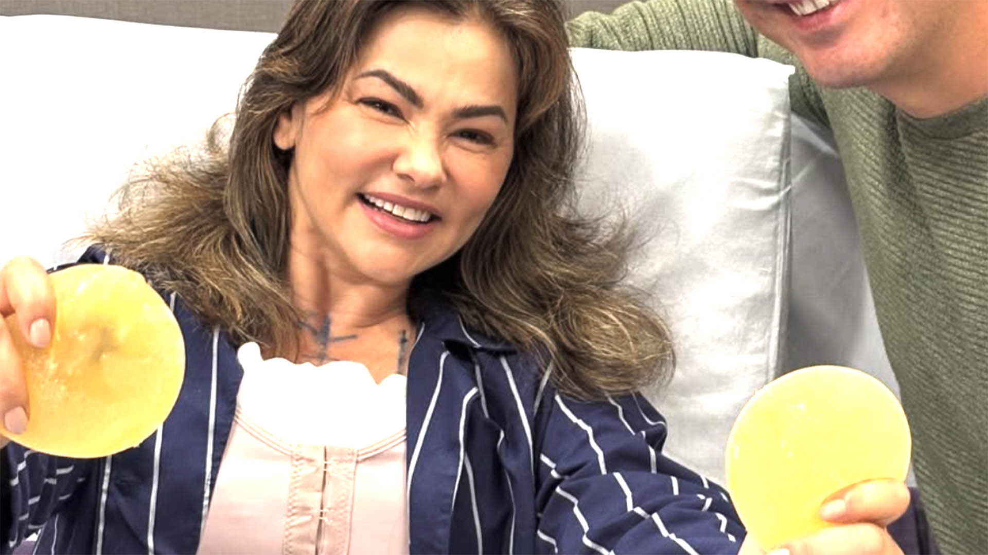 Suzana Alves, ex-Tiazinha, exibe foto no pós-operatório: ‘Natural novamente’