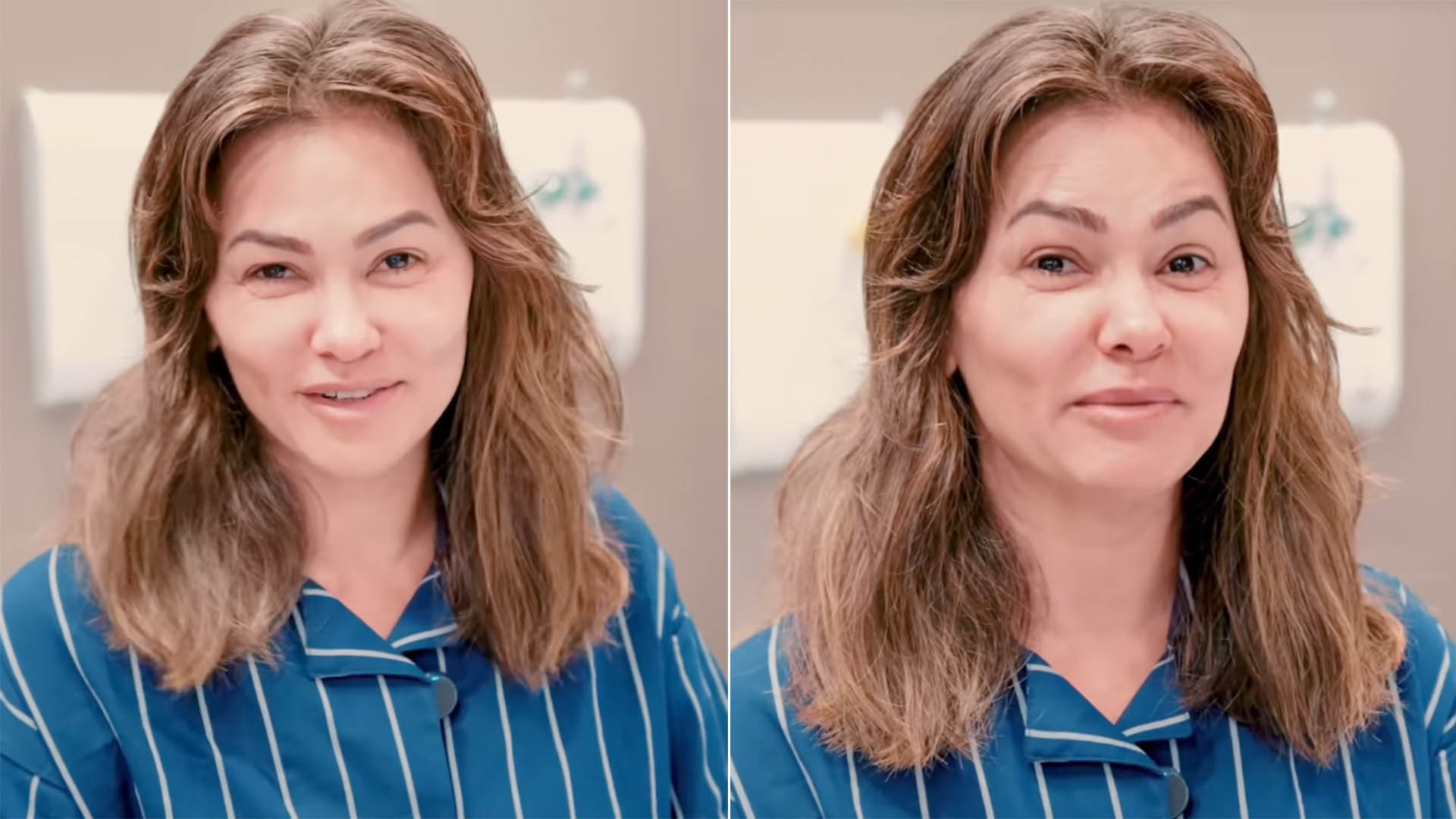 Recém-separada, Suzana Alves passa por cirurgia plástica
