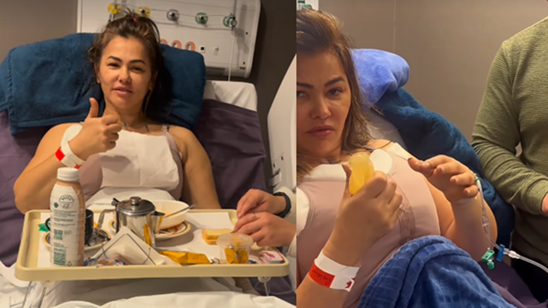 Suzana Alves, ex-Tiazinha, passa por cirurgia e médico explica: ‘Deformava’
