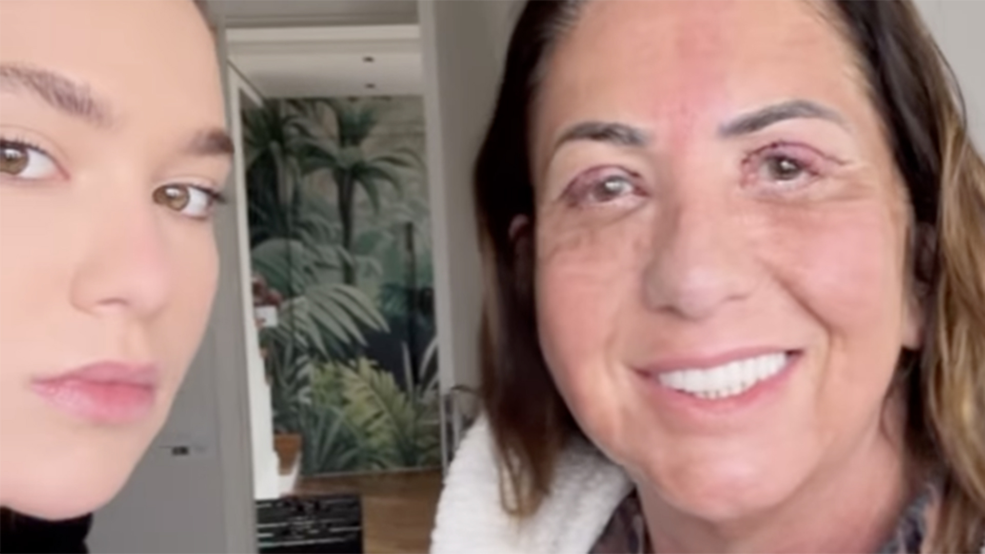 Virginia choca ao mostrar a quantidade de pele que foi tirada dos olhos da mãe