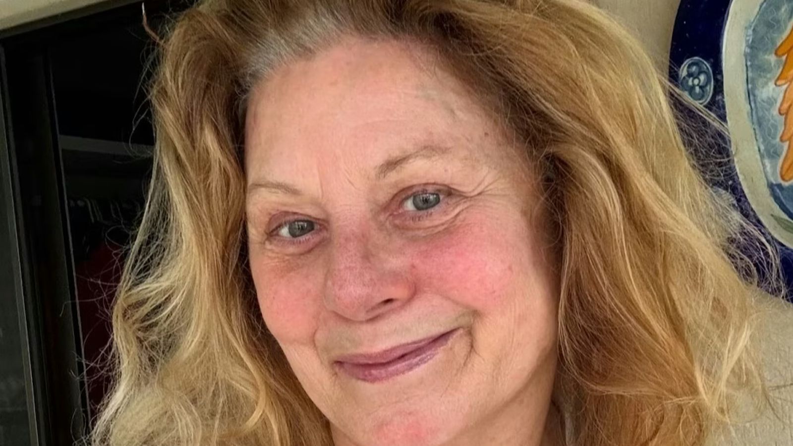 Vera Fischer desabafa sobre saúde e médico alerta: ‘Costuma se manifestar de forma súbita’