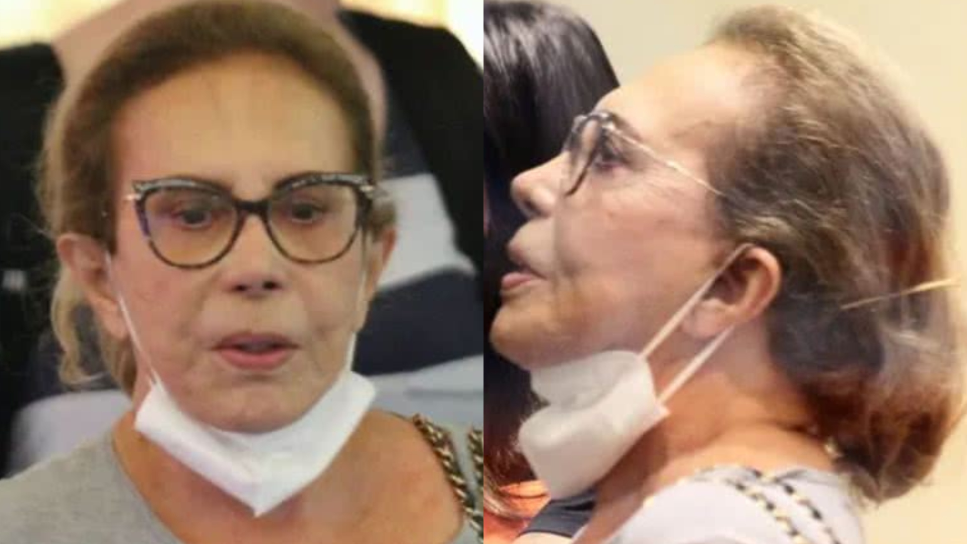 Médica alerta para a gravidade da doença diagnosticada em Arlete Salles: ‘Não existe cura’