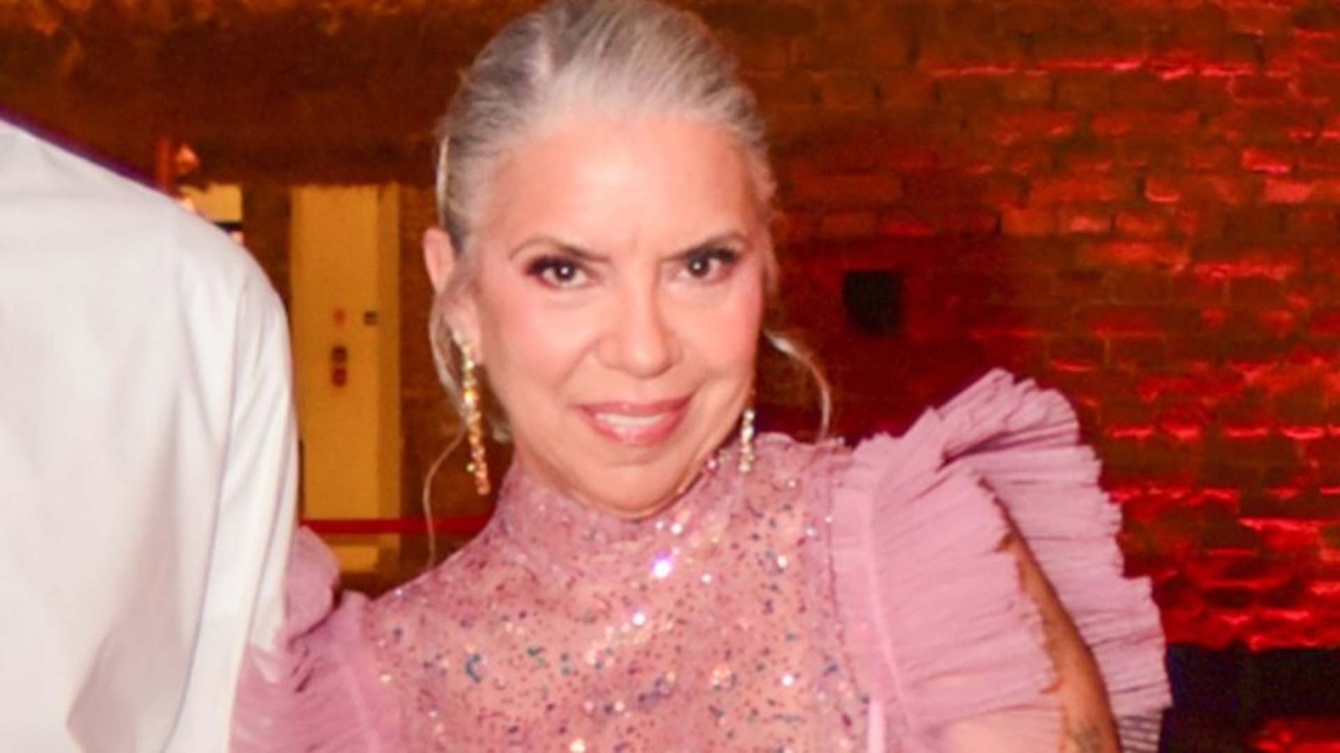 Médica explica diagnóstico da apresentadora Astrid Fontenelle: ‘Pode ser confundido’