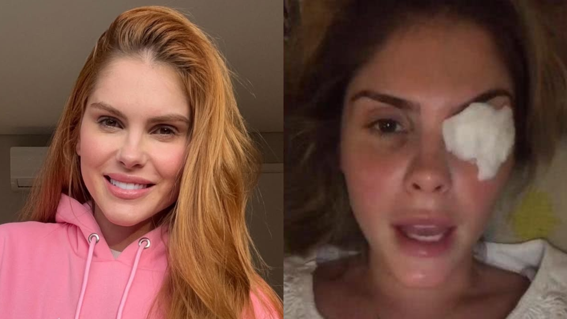 Médica faz alerta sobre o diagnóstico de Bárbara Evans e revela riscos: ‘Há um aumento’