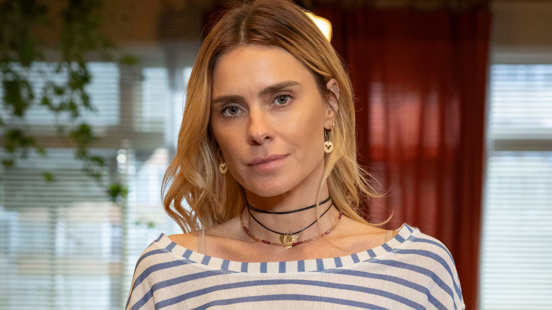 Médica faz alerta sobre riscos do loiro como o de Carolina Dieckmann em Vale Tudo