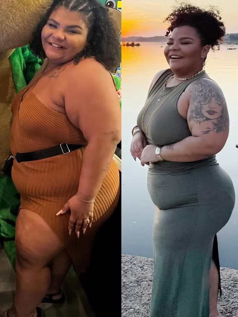 Flora Cruz mostra antes e depois do processo de emagrecimento - Foto: Reprodu&ccedil;&atilde;o/Instagram 