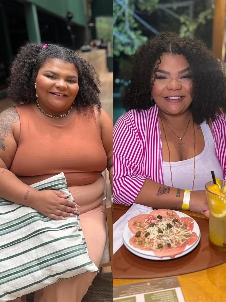 Flora Cruz mostra antes e depois do processo de emagrecimento - Foto: Reprodu&ccedil;&atilde;o/Instagram 