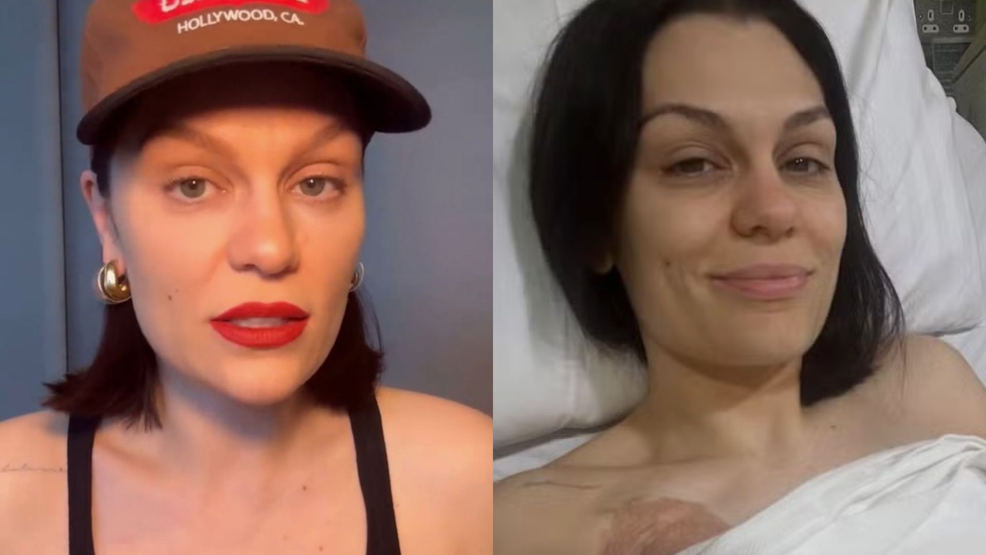 Os sintomas que Jessie J sentiu antes do diagnóstico de câncer de mama
