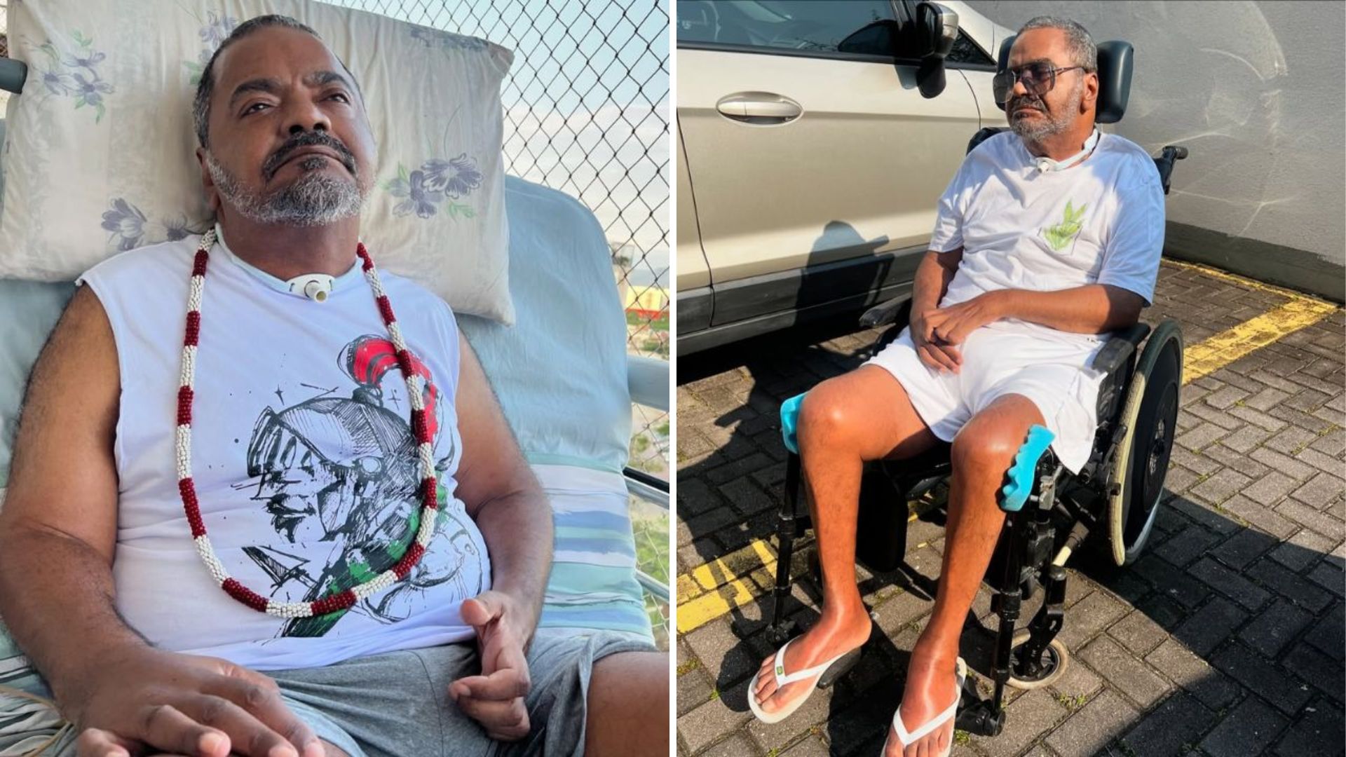Médico sobre ponto crítico da morte de Arlindo Cruz: ‘Não consegue suprir’