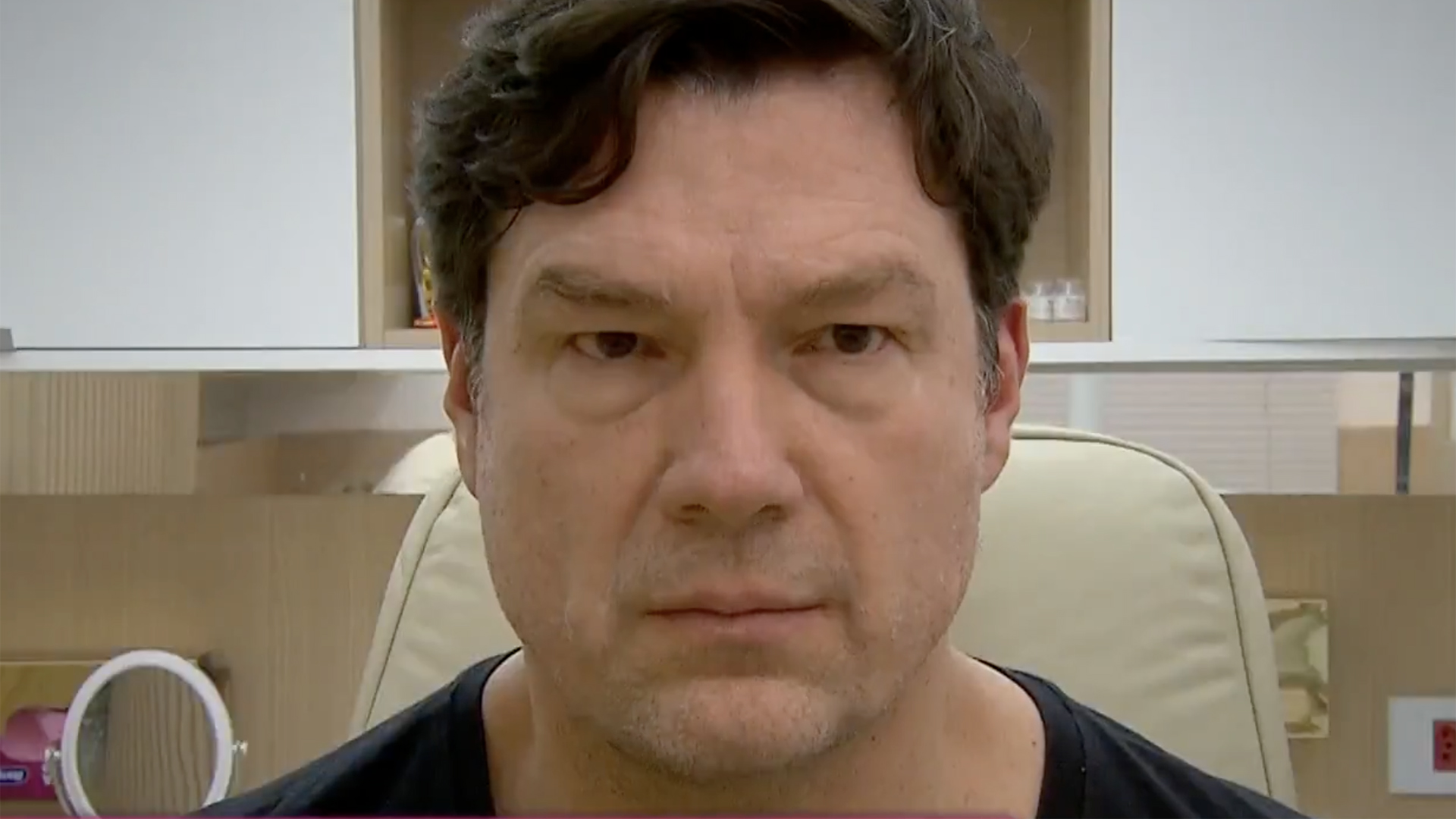 Ricardo Macchi, o Cigano Igor, exibe antes e depois da harmonização facial