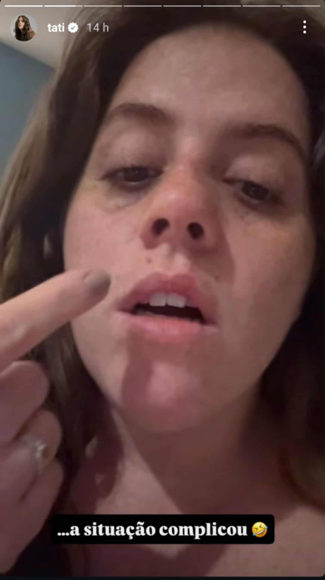 Tati Machado sofre acidente com o cachorro
