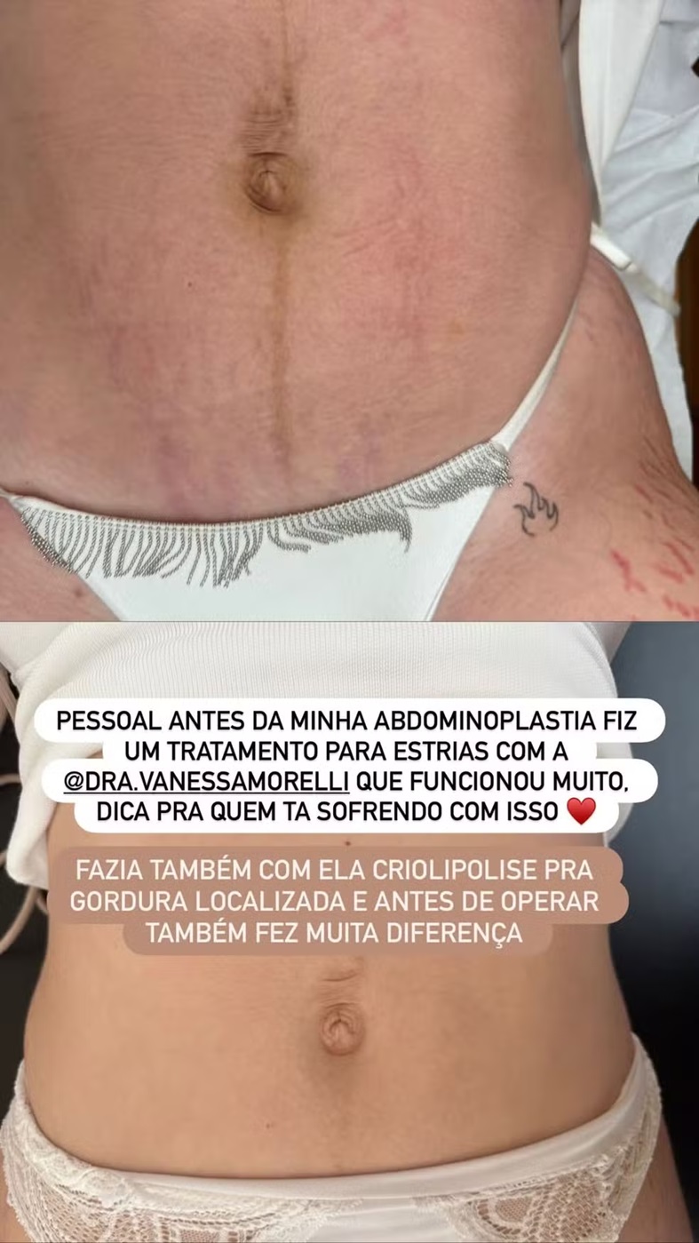 Storie de Viih Tube no Instagram