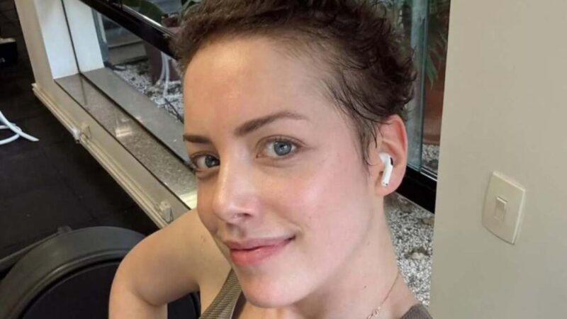 Especialista avalia caso como o de Fabiana Justus: ‘A avaliação pré-operatória é minuciosa’