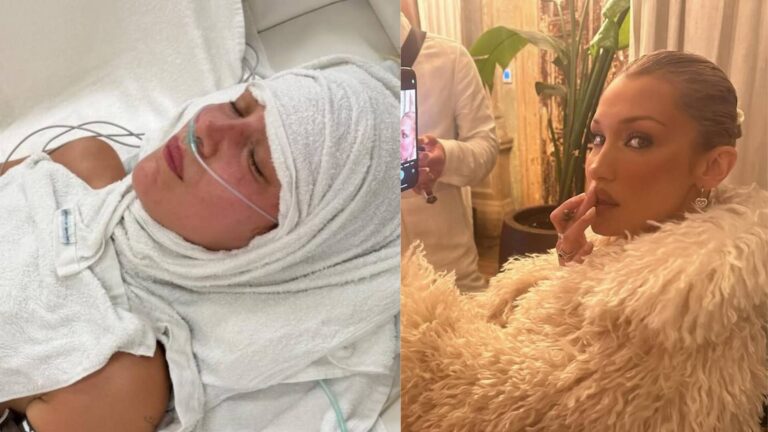 Após internação de Bella Hadid, médico alerta: ‘O paciente nem percebe’