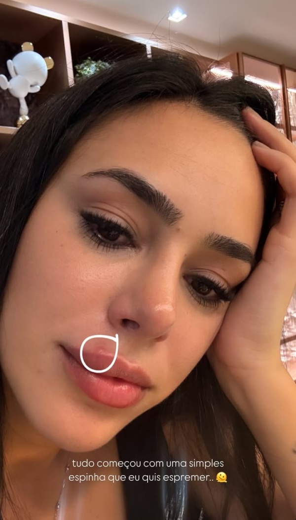 Bruna Biancardi revela que teve celulite facial - Foto: Instagram