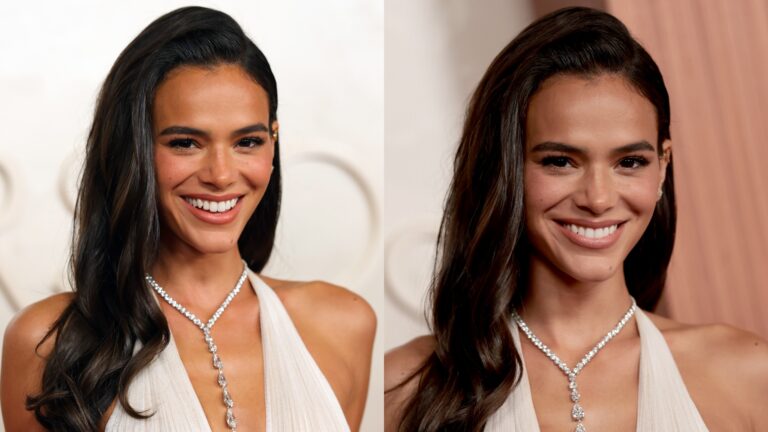 Dentista alerta sobre moda de copiar sorriso de Bruna Marquezine: ‘Pressão’