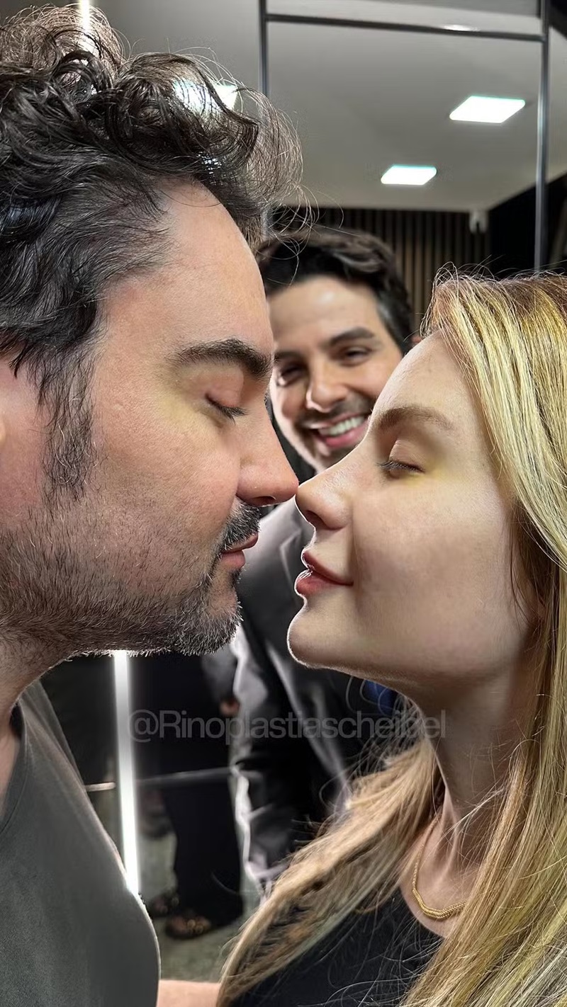 Fernando Zor e Lara Bissi mostram resultados de suas rinoplastias &mdash; Foto: Reprodu&ccedil;&atilde;o/Instagram